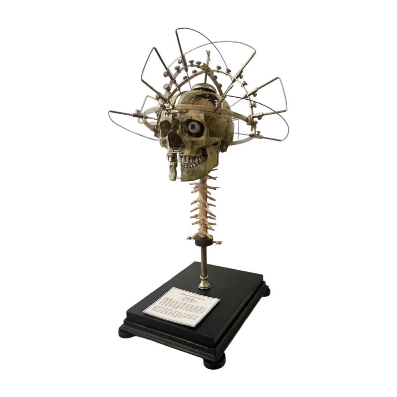 Michel de Spiegeleire “Homo sapiens” sculptuur elektrogalvanisch wezen, voorwerp van nieuwsgierigheid