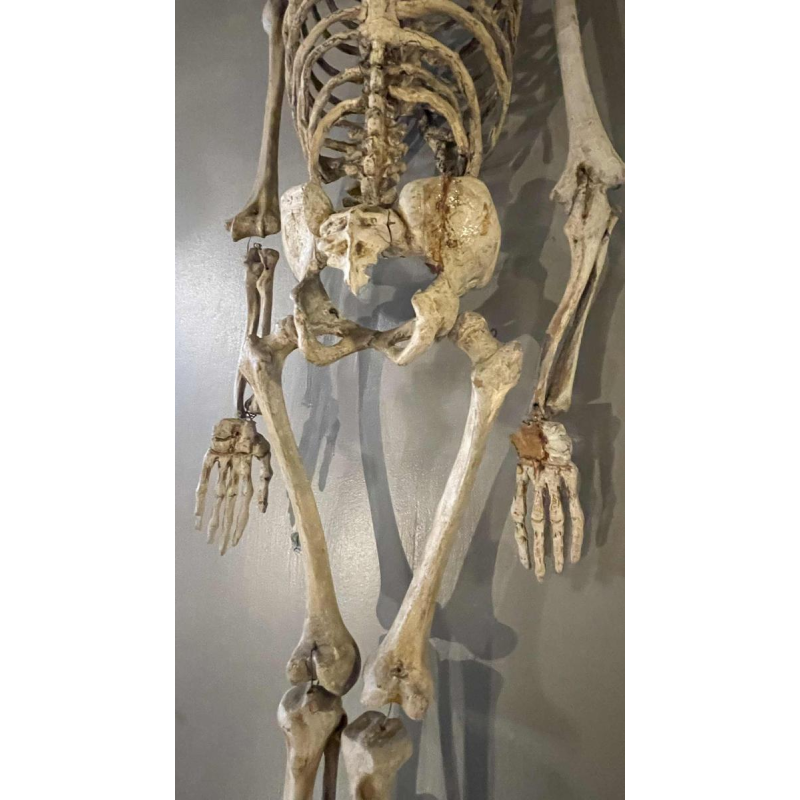 Antiek gelede menselijk skelet (70cm) in gestuukt houtsnijwerk, curiositeitsobject, 19e eeuw