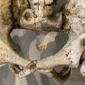 Antiek gelede menselijk skelet (70cm) in gestuukt houtsnijwerk, curiositeitsobject, 19e eeuw